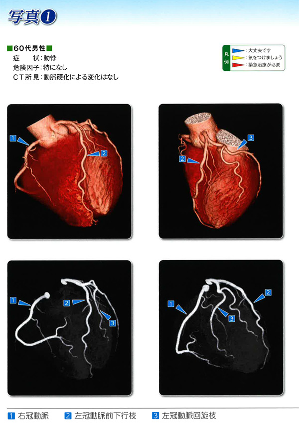 心臓CT検査